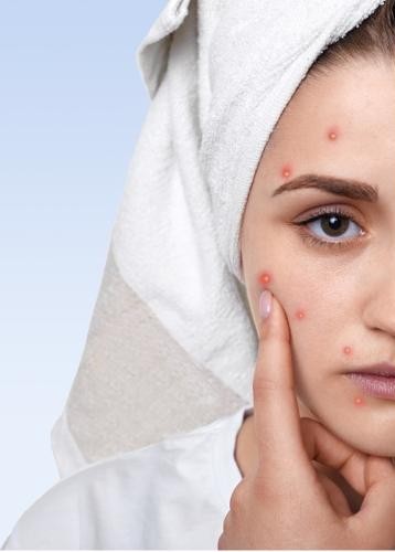 TeenClean – Odborný štart pre mladých